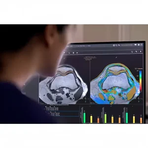 В Няганской окружной больнице введён в эксплуатацию магнитно-резонансный томограф нового поколения.