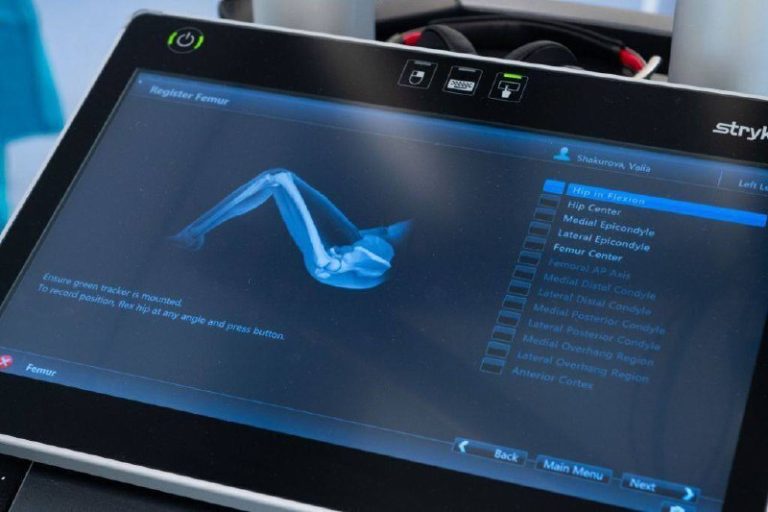 В Тюмени провели первую операцию по замене сустава с использованием стойки компьютерной навигации.