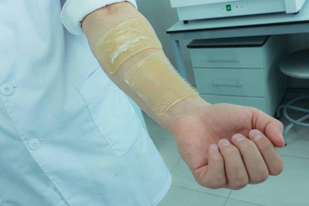 Югорские учёные создали „БиоКожу“ — повязки для ускоренного заживления ран и ожогов